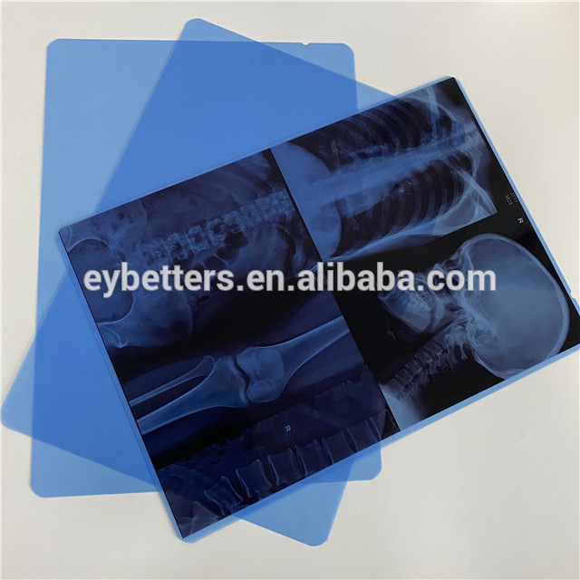 35x35mm mefical x ray film/ darkroom conventional film/wet film