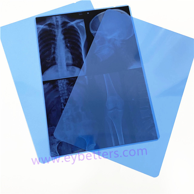 8x10inch 14x17inch PET Blue Inkjet Printing Medical X-Ray Film